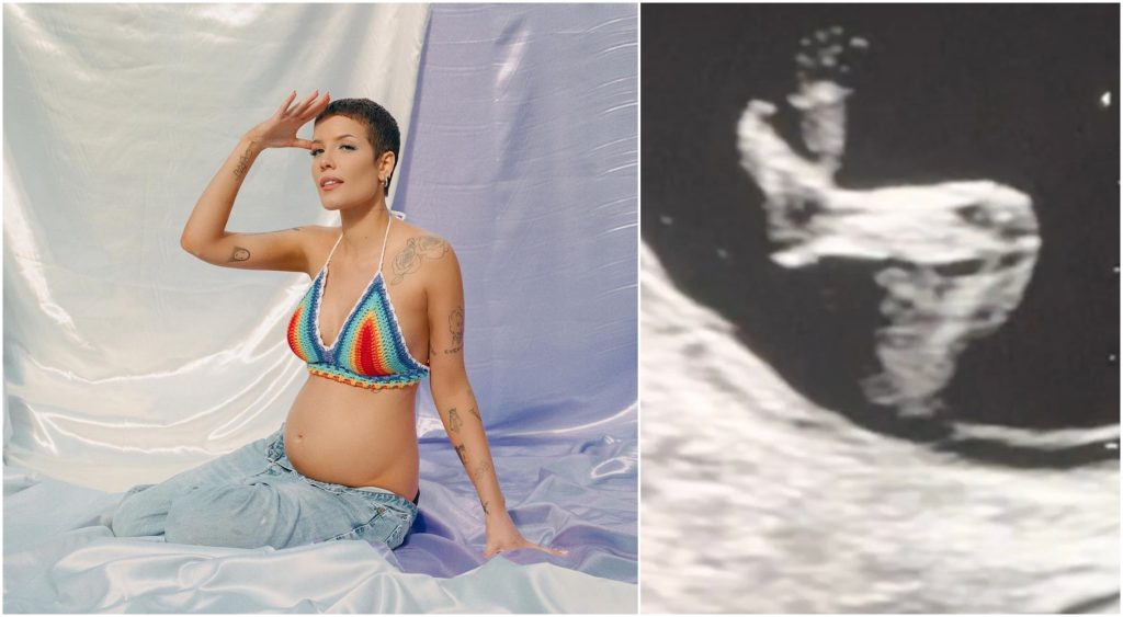 halsey maternity shoot sonogram