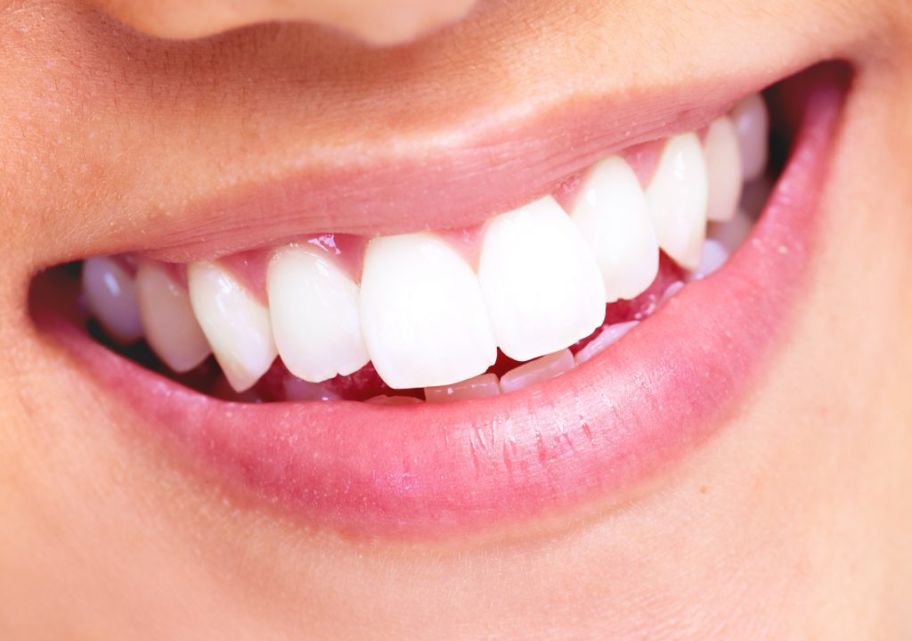 smile whiter crawford jarvis family dental shreveport
