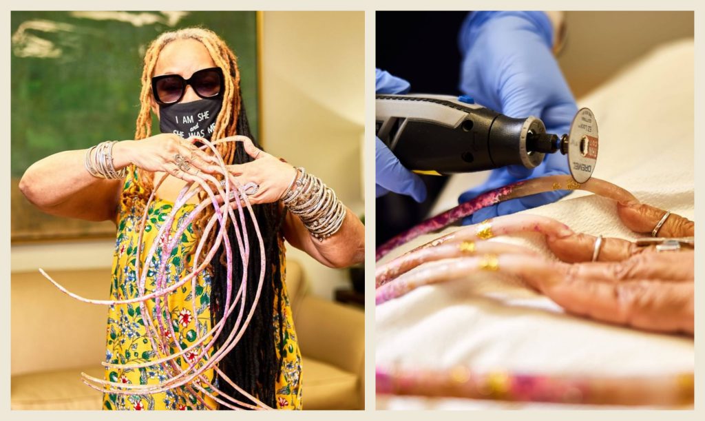 Woman With "World's Longest Fingernails" Finally Cuts Them After Nearly Three Decades