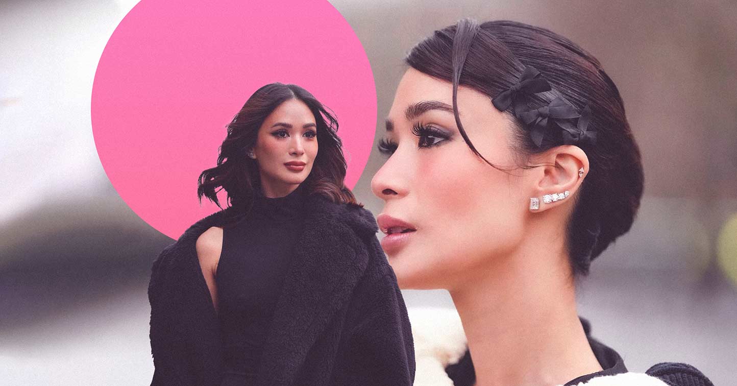Heart Evangelista Shares Traumatic Lip Fillers Experience thumbnail